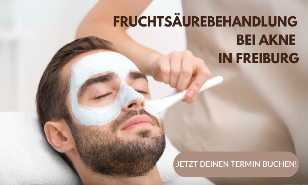 fruchsaeurebehandlung_bei_akne_freiburg_popup